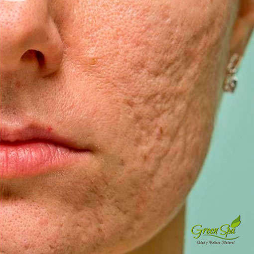 GREEN SPA SERVICIOS EL SALVADOR